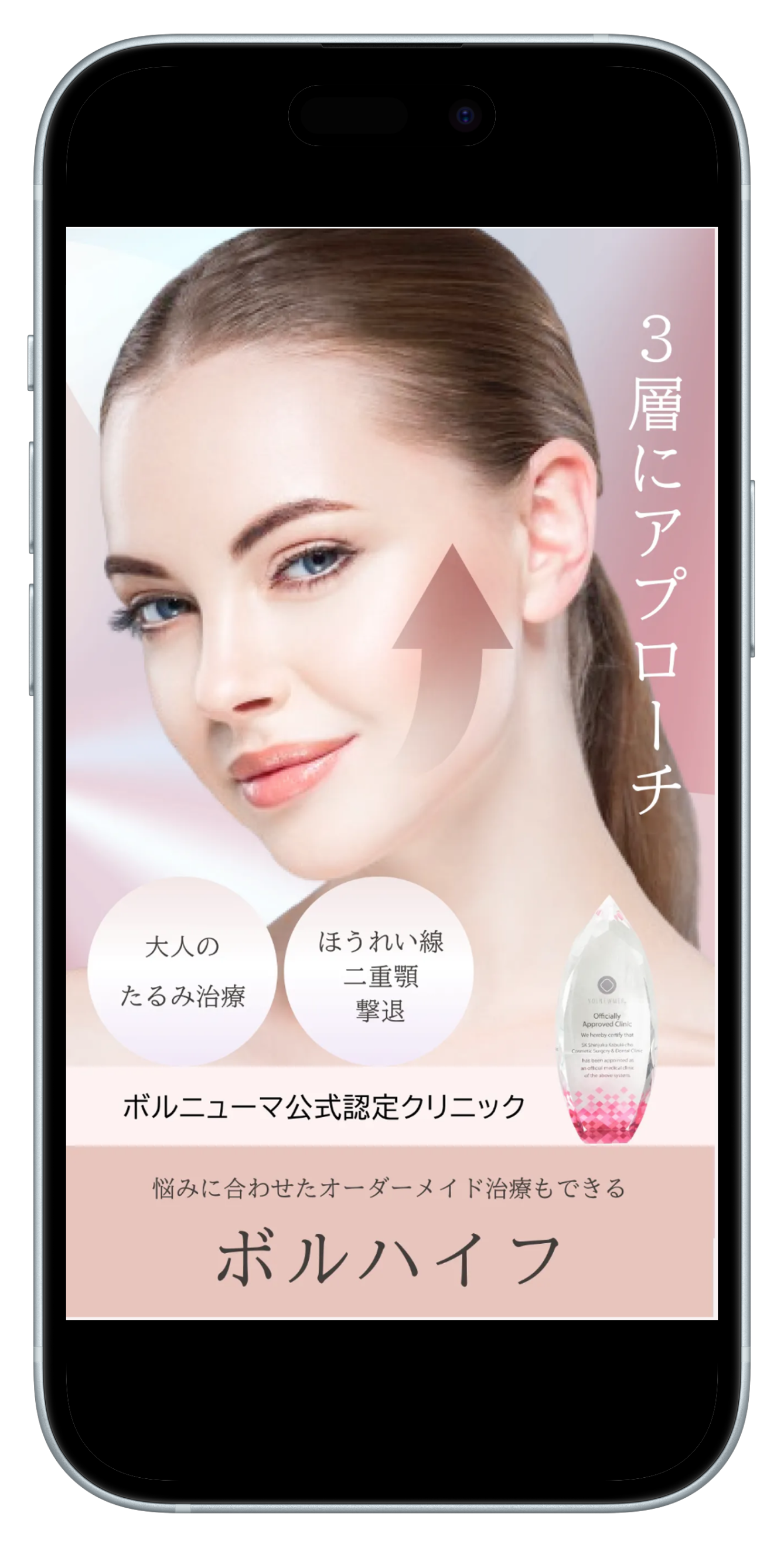 hifu.webp